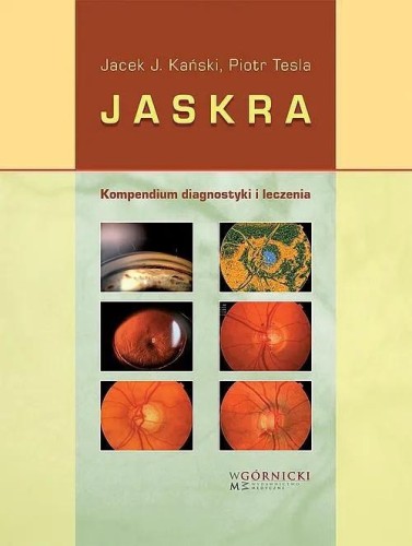 Jaskra. Kompendium diagnostyki i terapii