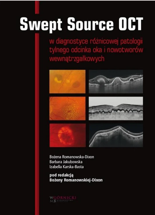 Swept Source OCT w diagnostyce patologii tylnego..