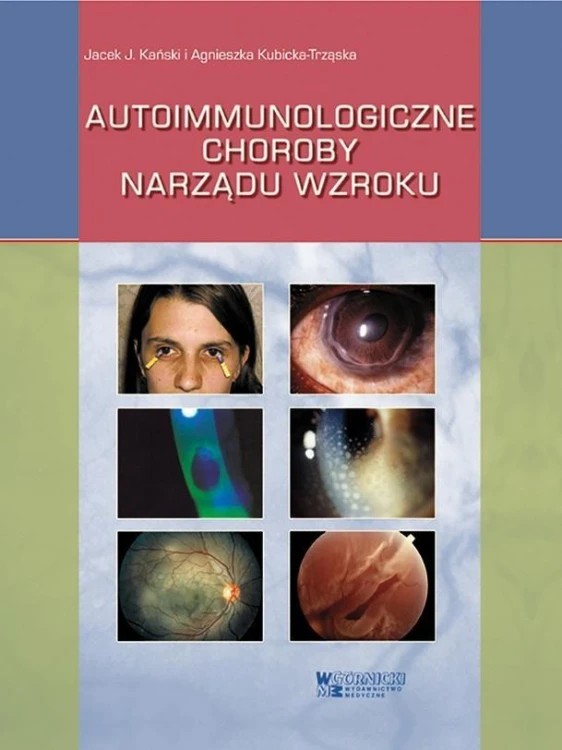 Autoimmunologiczne choroby narządu wzroku
