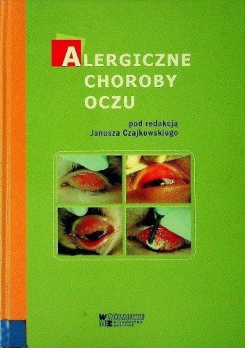 Alergiczne choroby oczu, red. Janusz Czajkowski