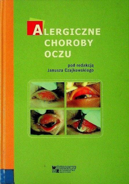 Alergiczne choroby oczu, red. Janusz Czajkowski