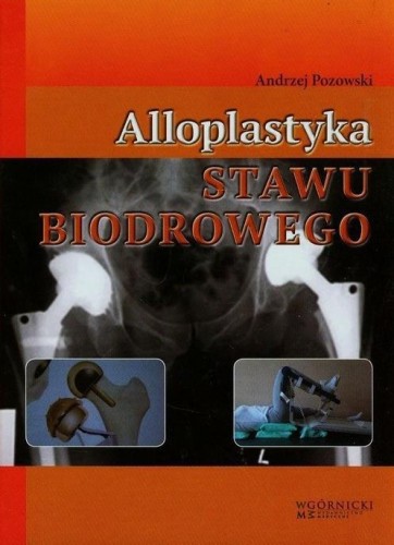 Alloplastyka stawu biodrowego, Andrzej Pozowski