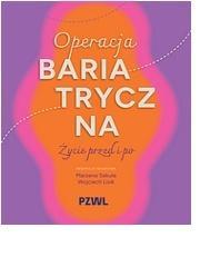 Operacja bariatryczna. Życie przed i po