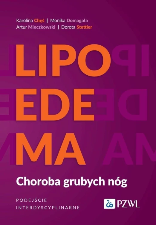 Lipoedema. Choroba grubych nóg, praca zbiorowa