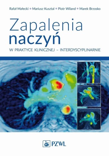 Zapalenia naczyń w praktyce klinicznej...