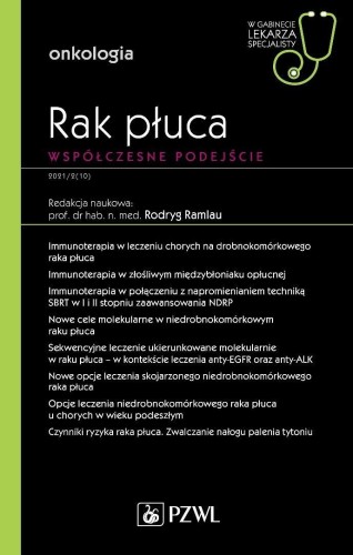 Rak płuca. Współczesne podejście. W gabinecie
